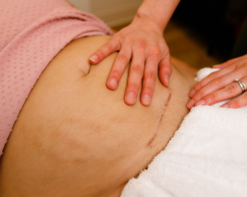 https://www.bumpphysioco.ca/wp-content/uploads/2023/05/bump-physio-c-section-recovery.jpg